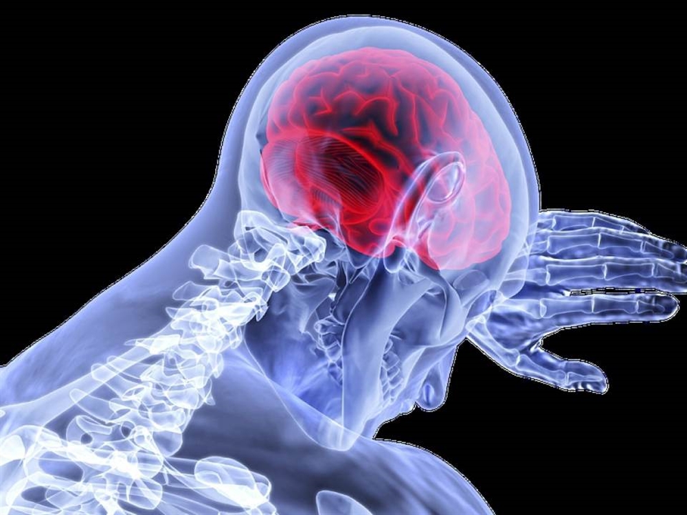 السكتة الدماغية.. الأعراض والفئات الأكثر عُرضة للإصابة
